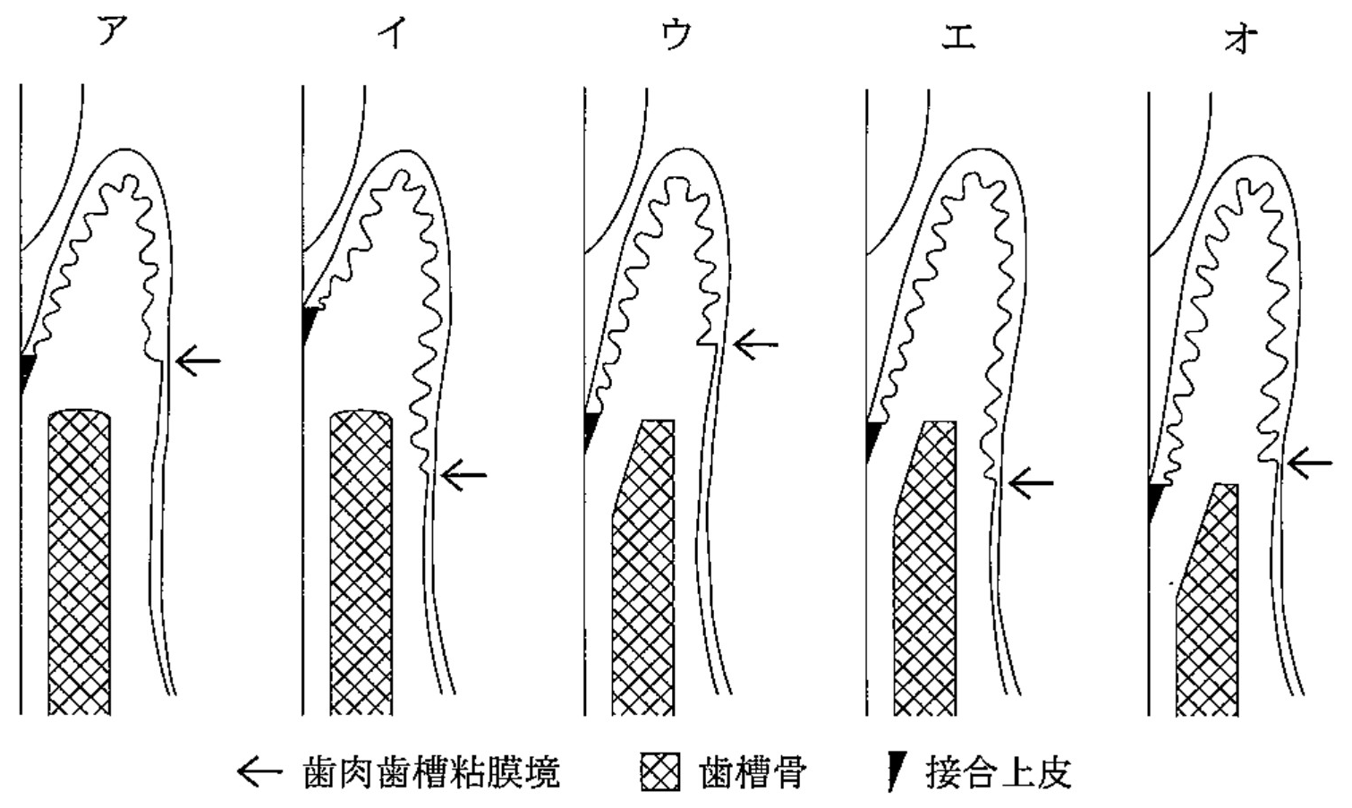 99B44 問題中の図