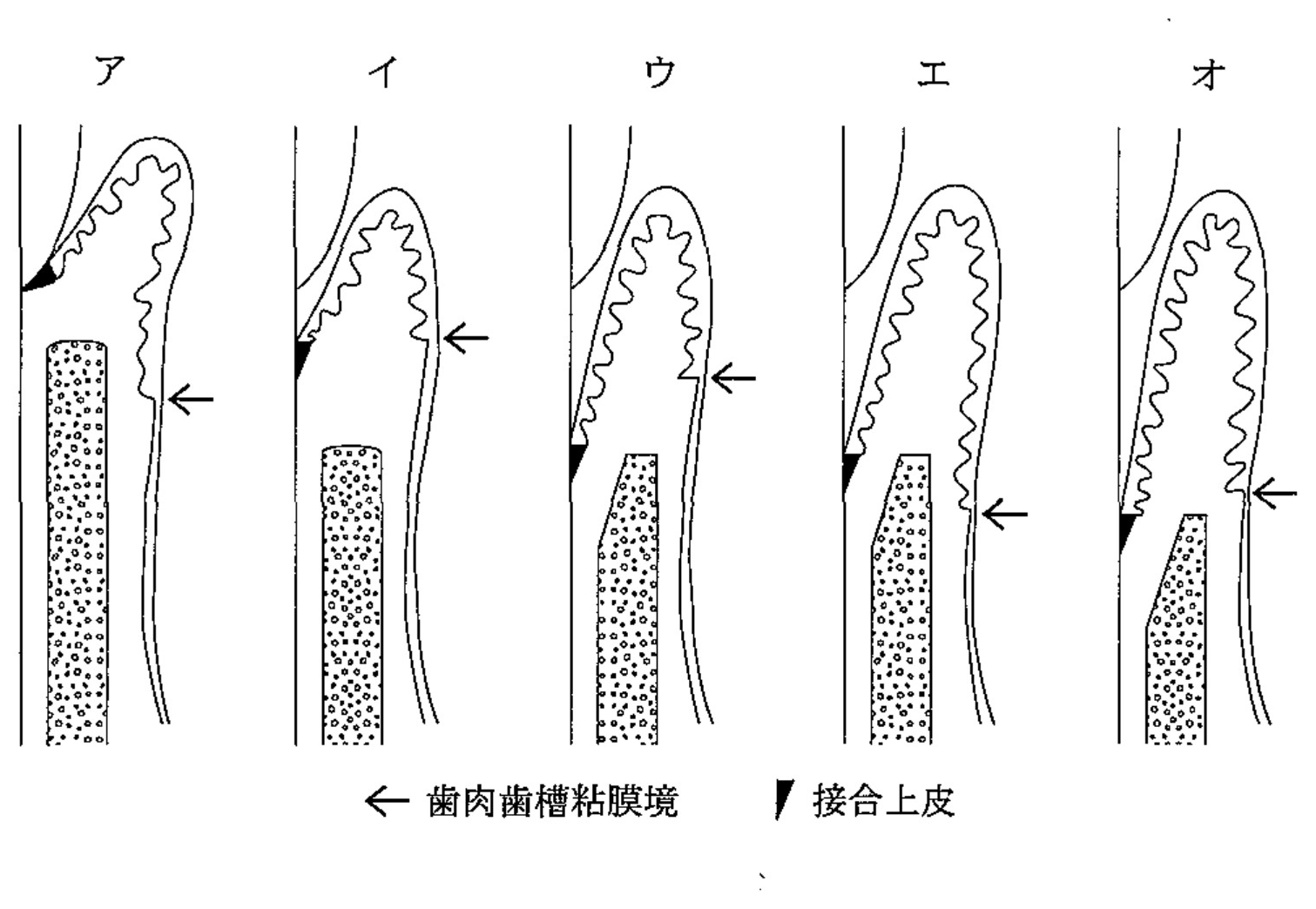 100B23 問題中の図