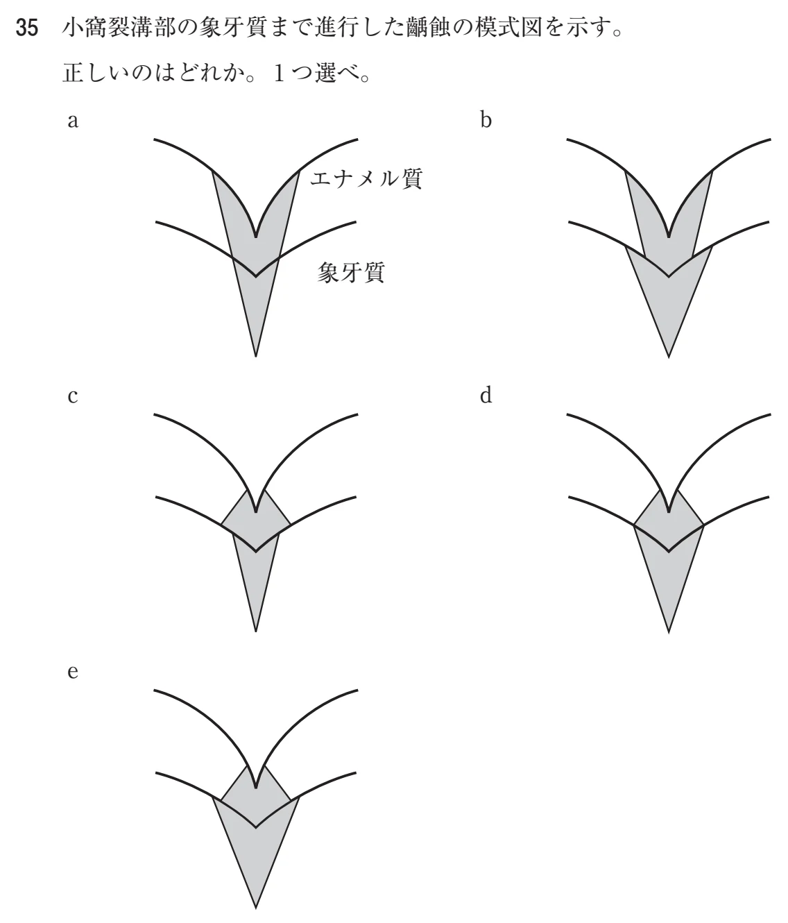 105C35 問題文（厚生労働省公表資料の切り出し）